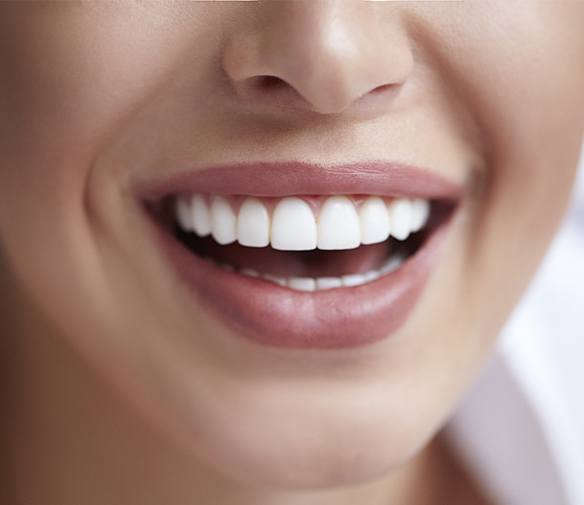 Flawless smile after metal free dental restoration